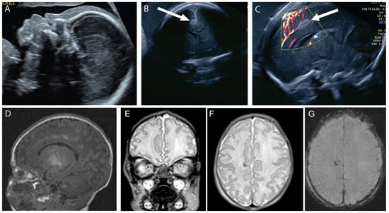 Diagnostics 14 02371 g003