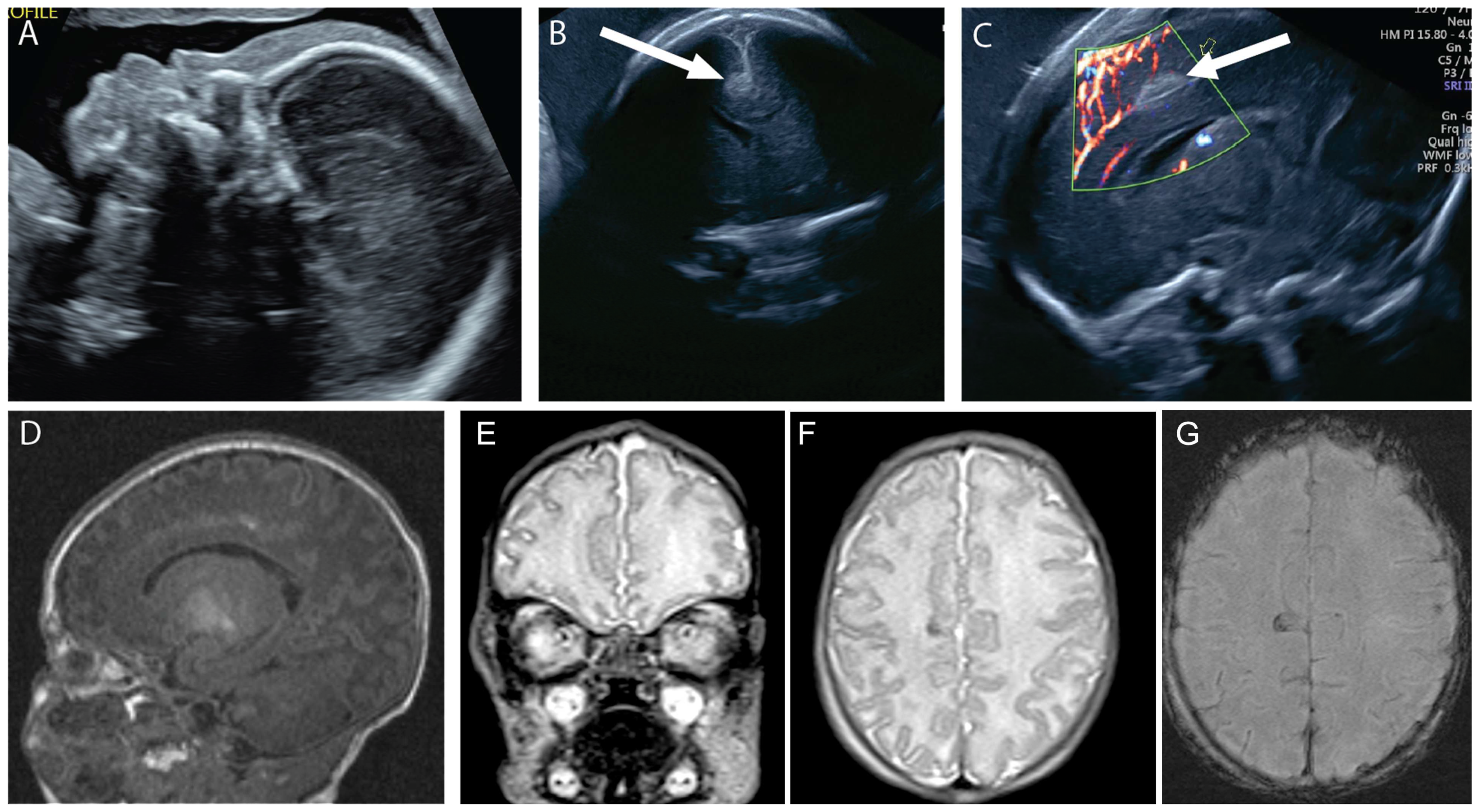 Diagnostics 14 02371 g003