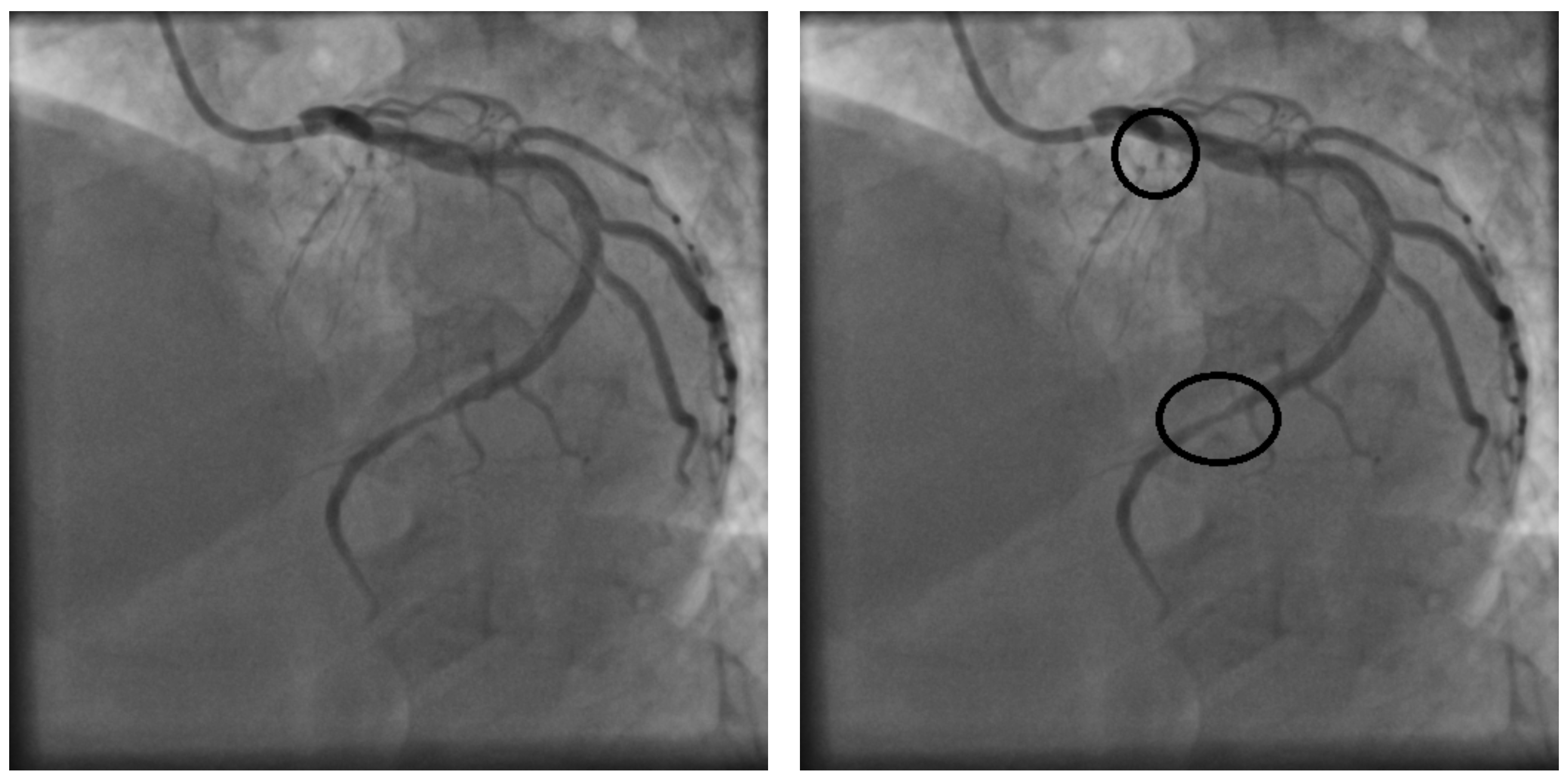 Diagnostics 14 02372 g002