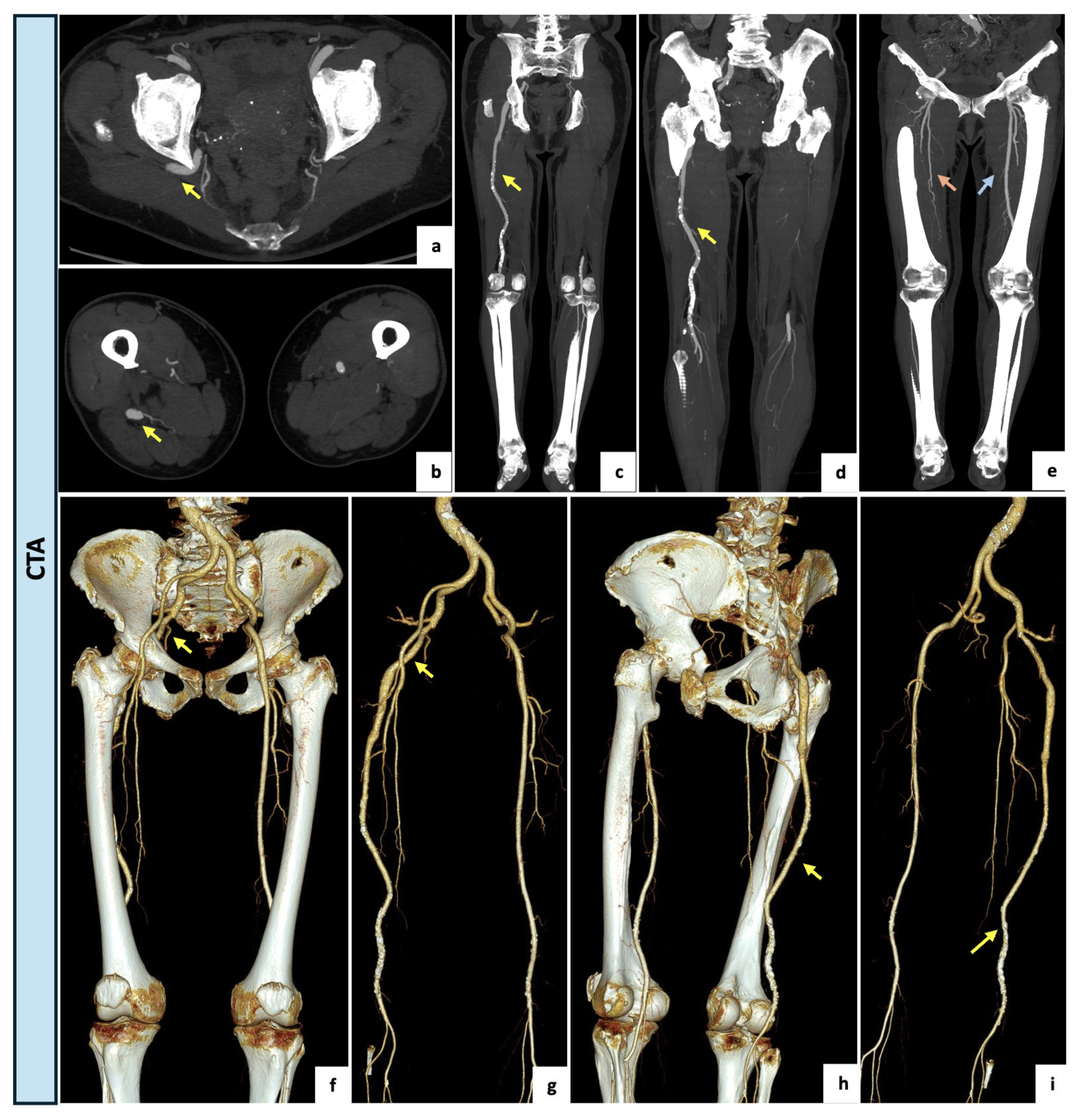 Diagnostics 14 02383 g004