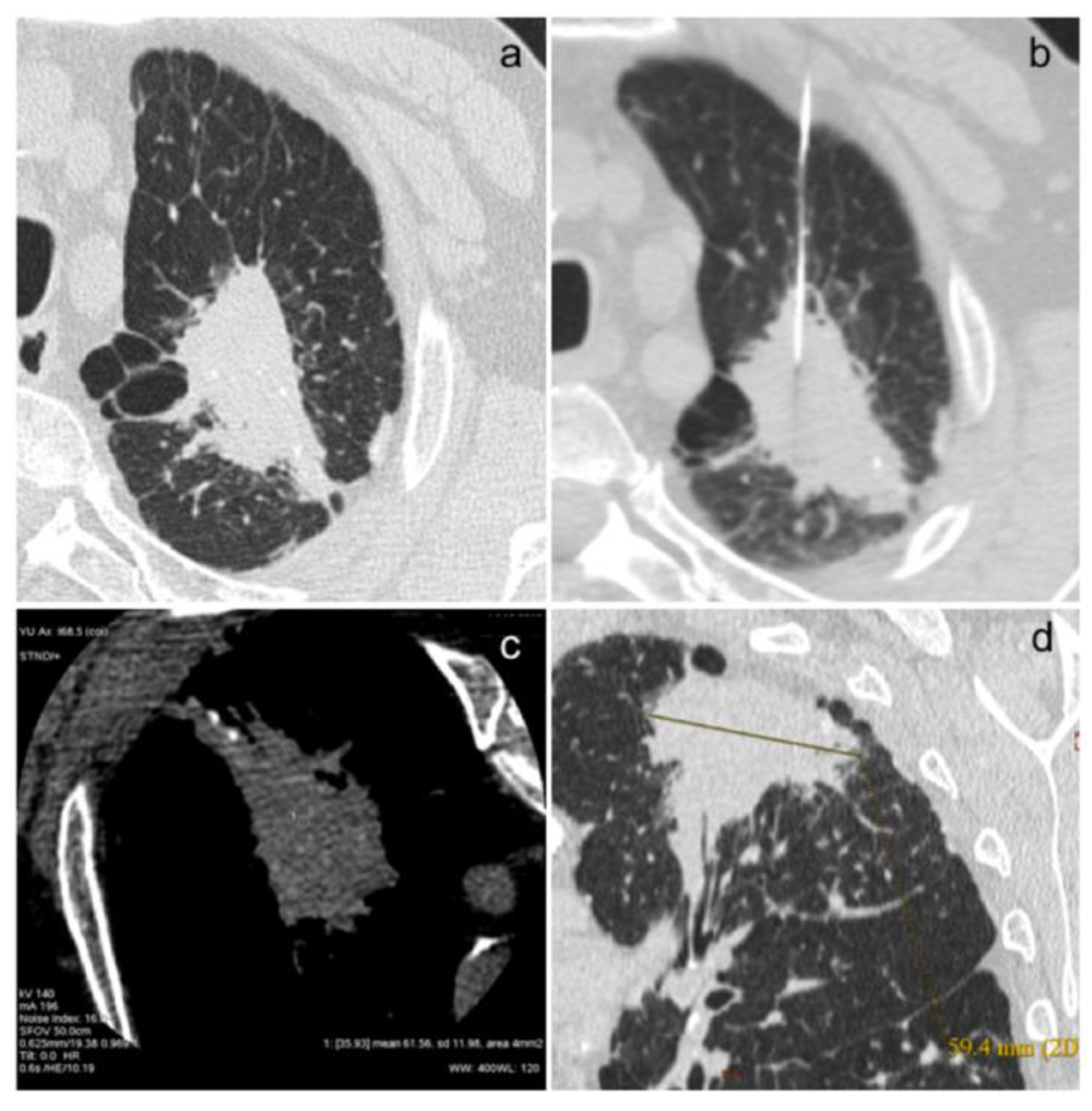 Diagnostics 14 02389 g001