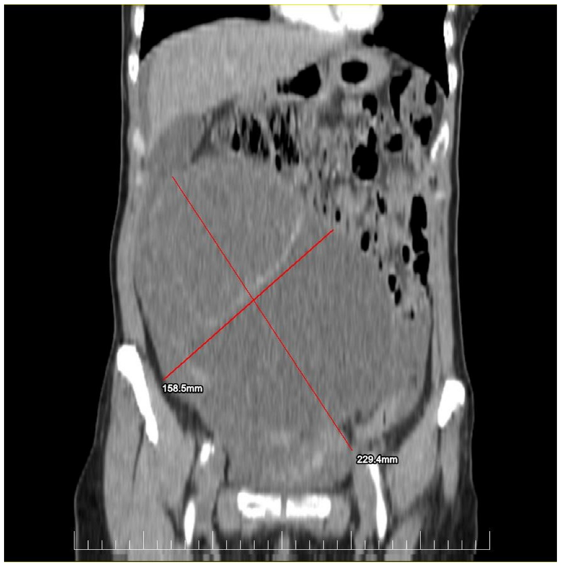 Diagnostics 14 02402 g001