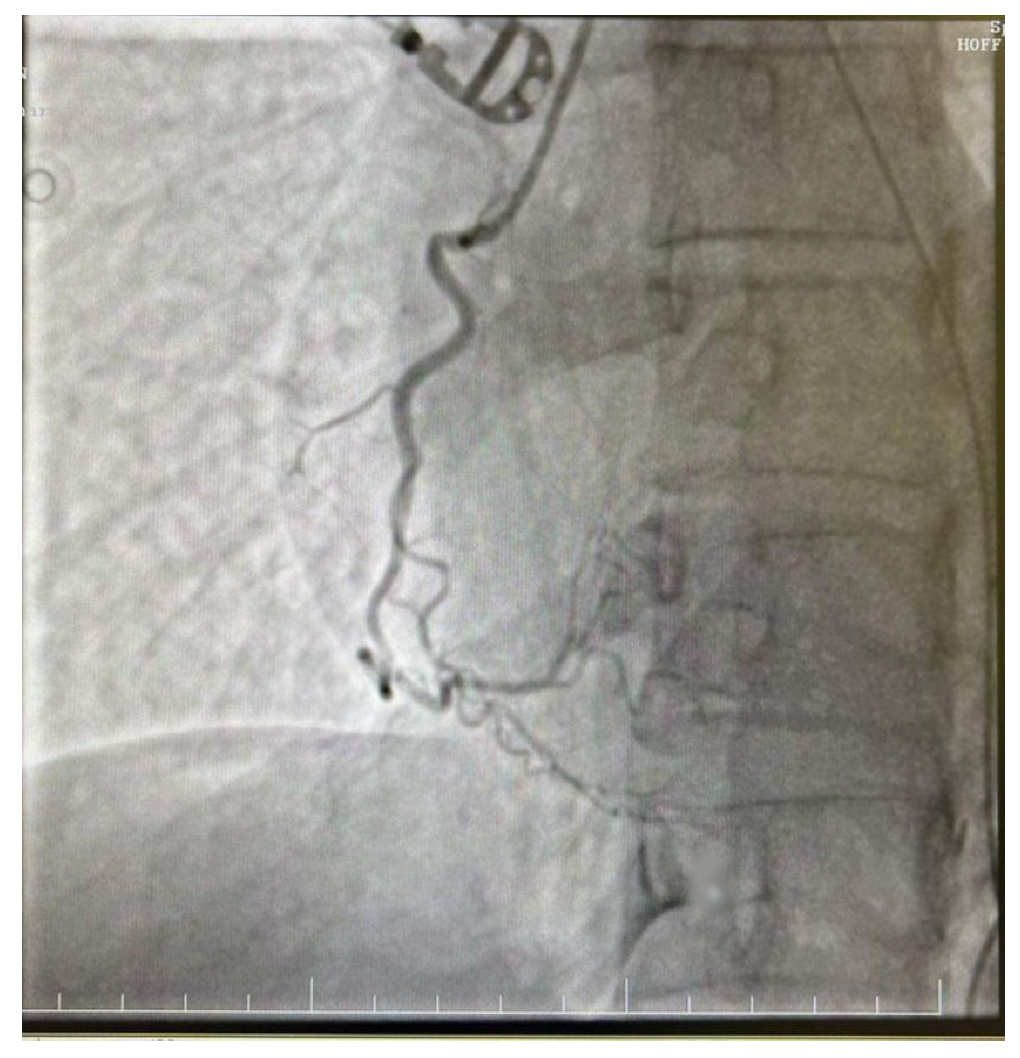 Diagnostics 14 02402 g005