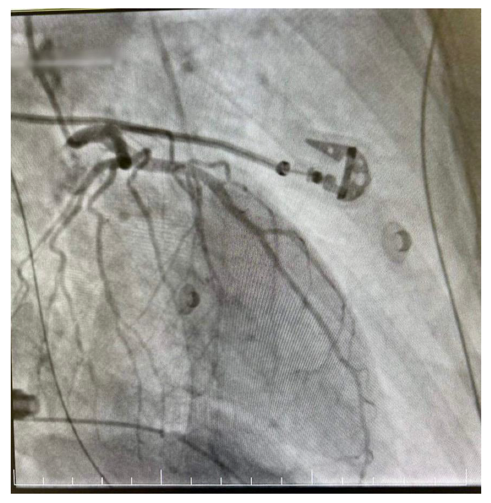 Diagnostics 14 02402 g006