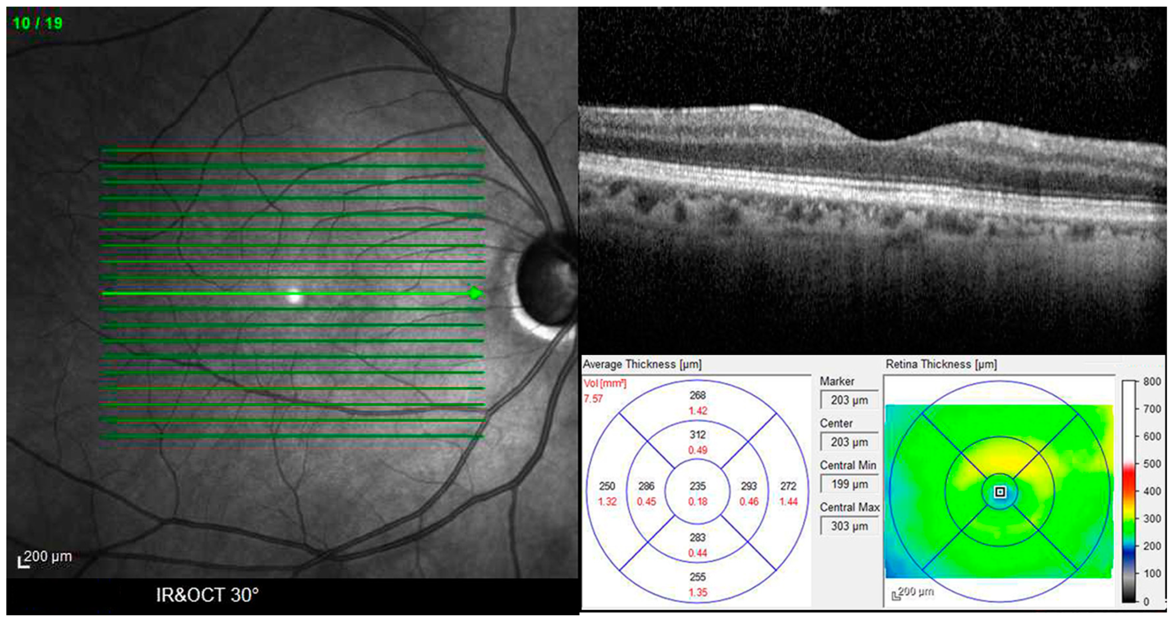 Diagnostics 14 02409 g001