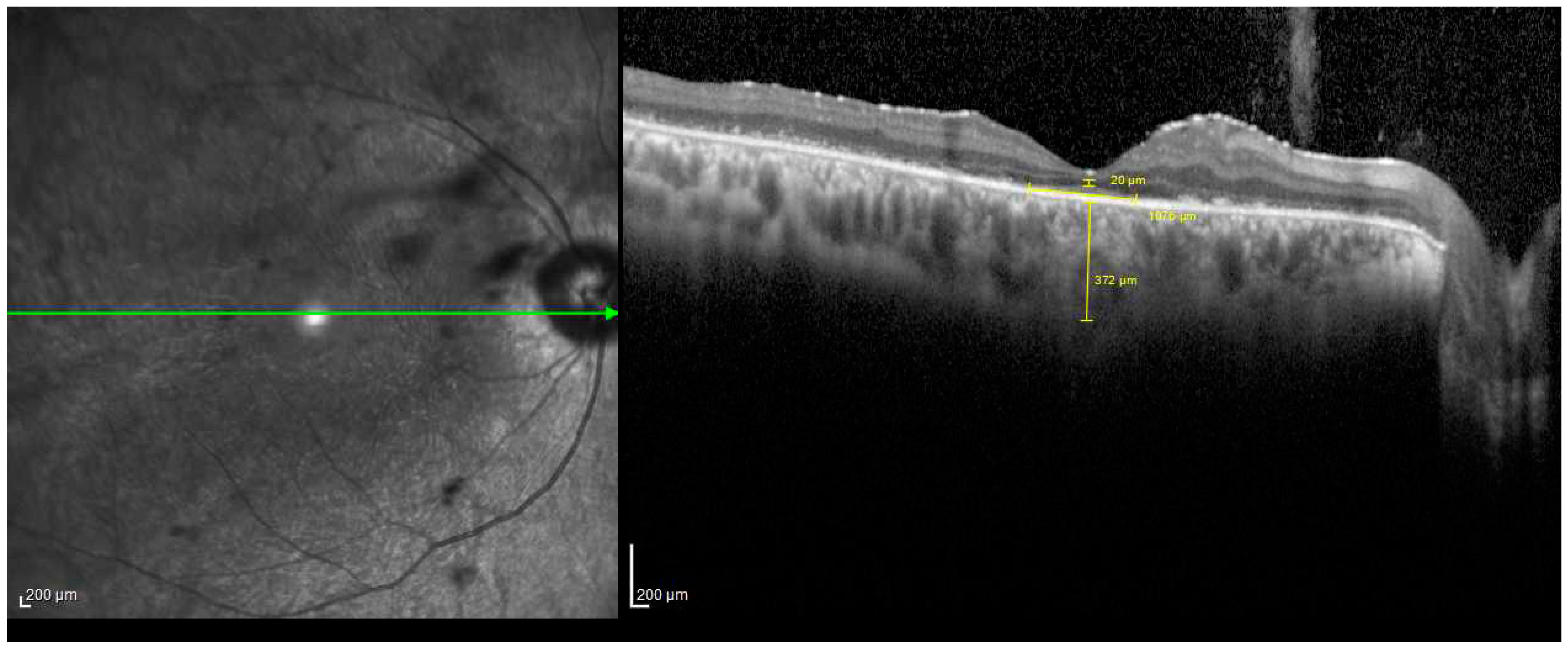 Diagnostics 14 02409 g003