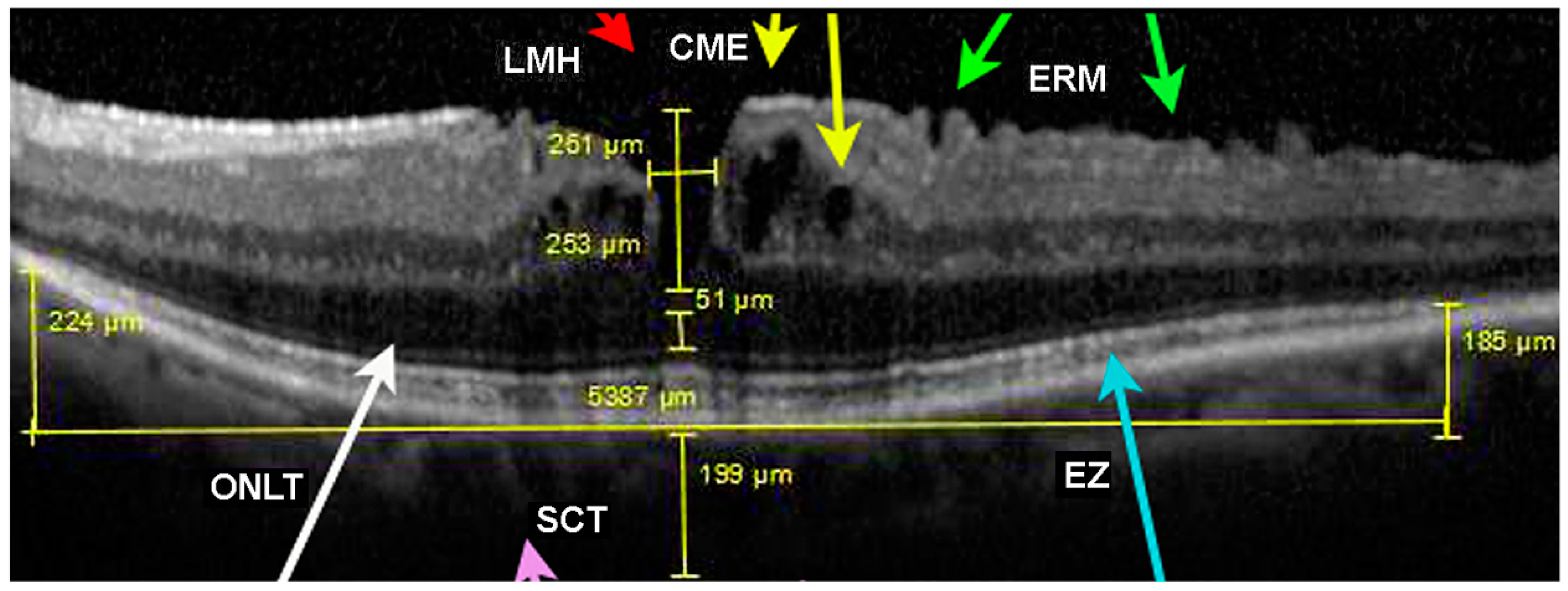 Diagnostics 14 02409 g004