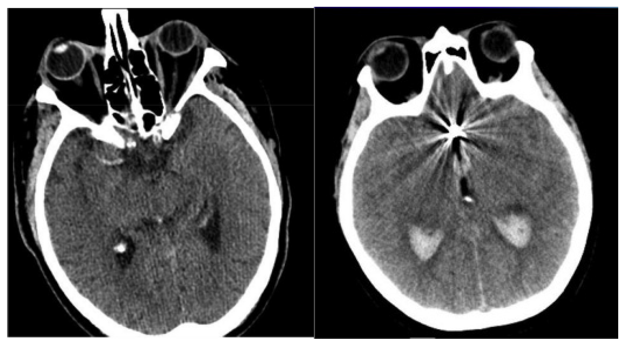 Diagnostics 14 02417 g002