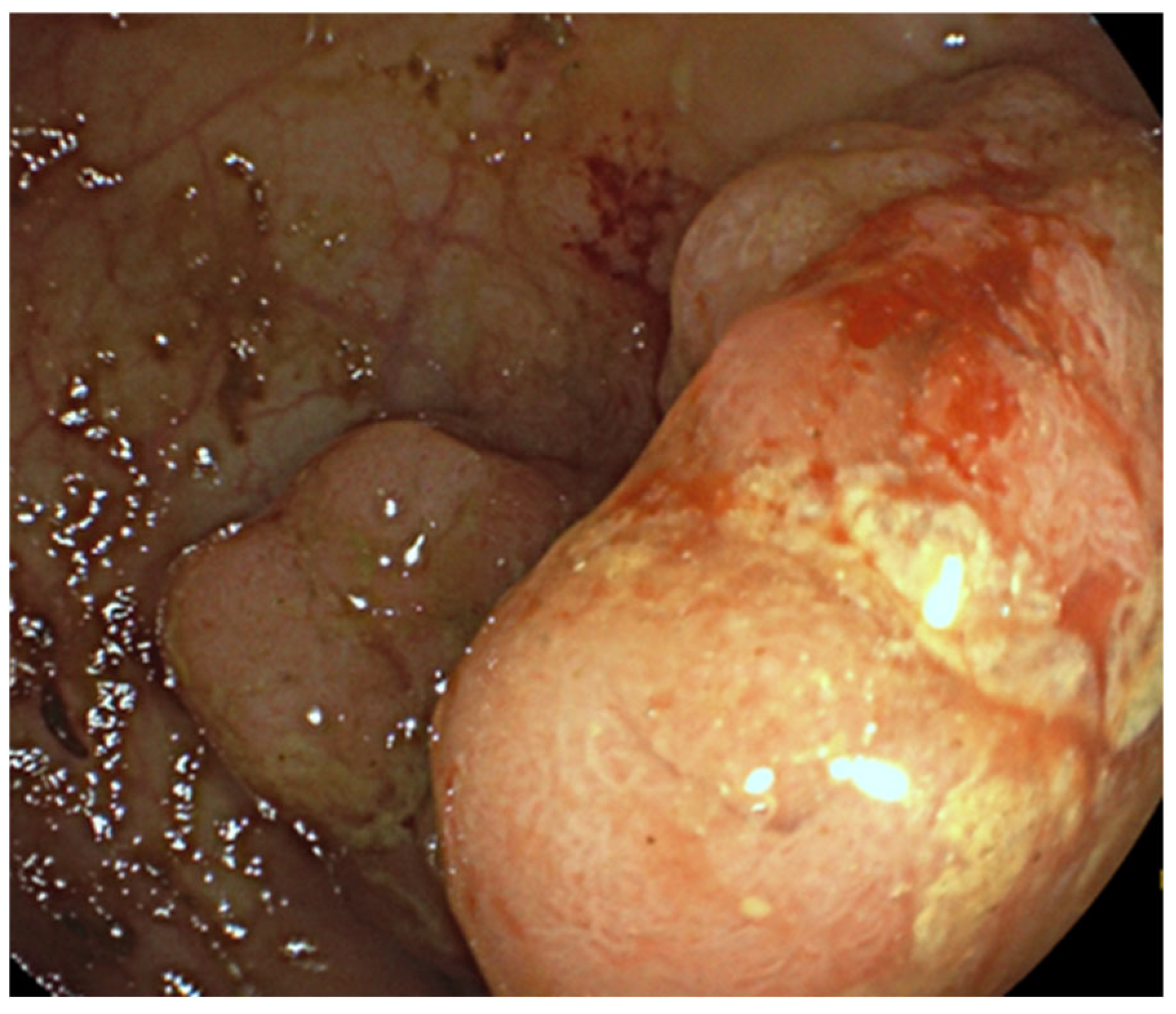 Diagnostics 14 02420 g001