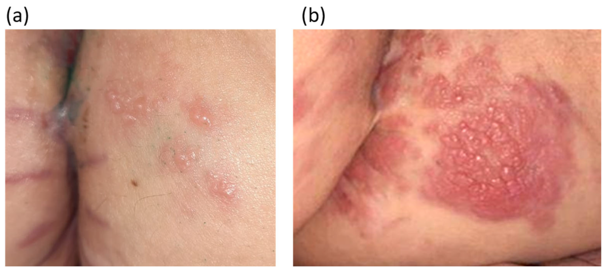 Diagnostics 14 02420 g003