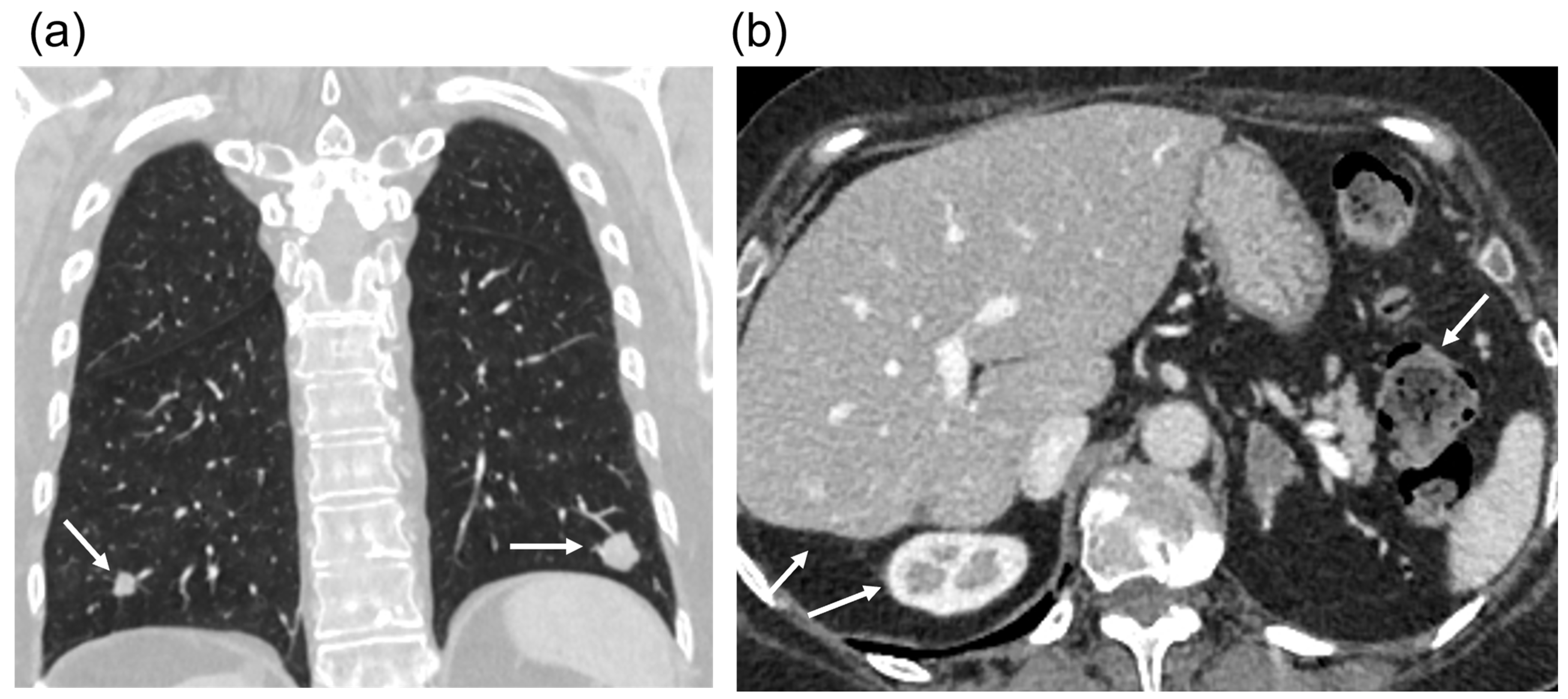 Diagnostics 14 02420 g005