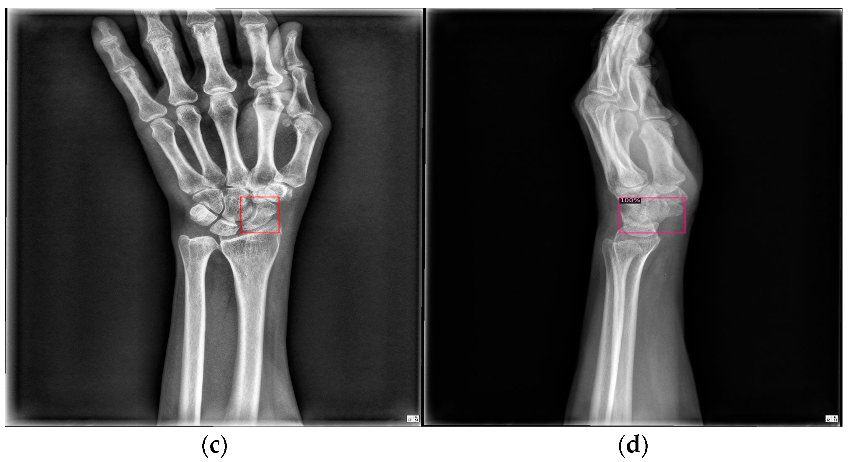 Diagnostics 14 02425 g009b