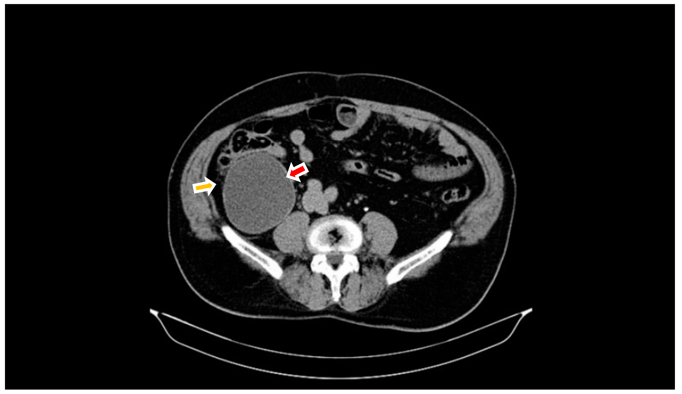 Diagnostics 14 02429 g002