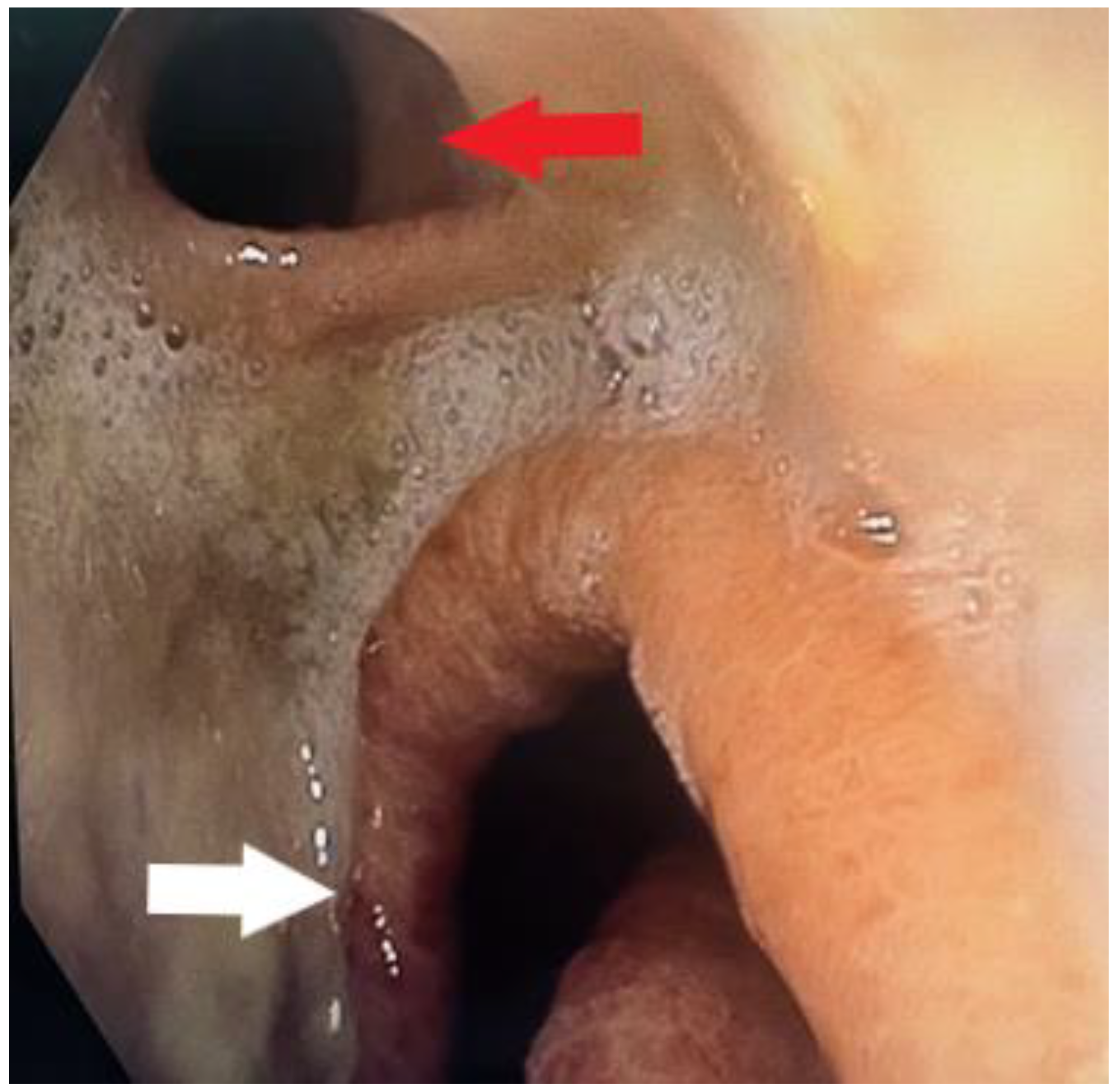 Diagnostics 14 02432 g001