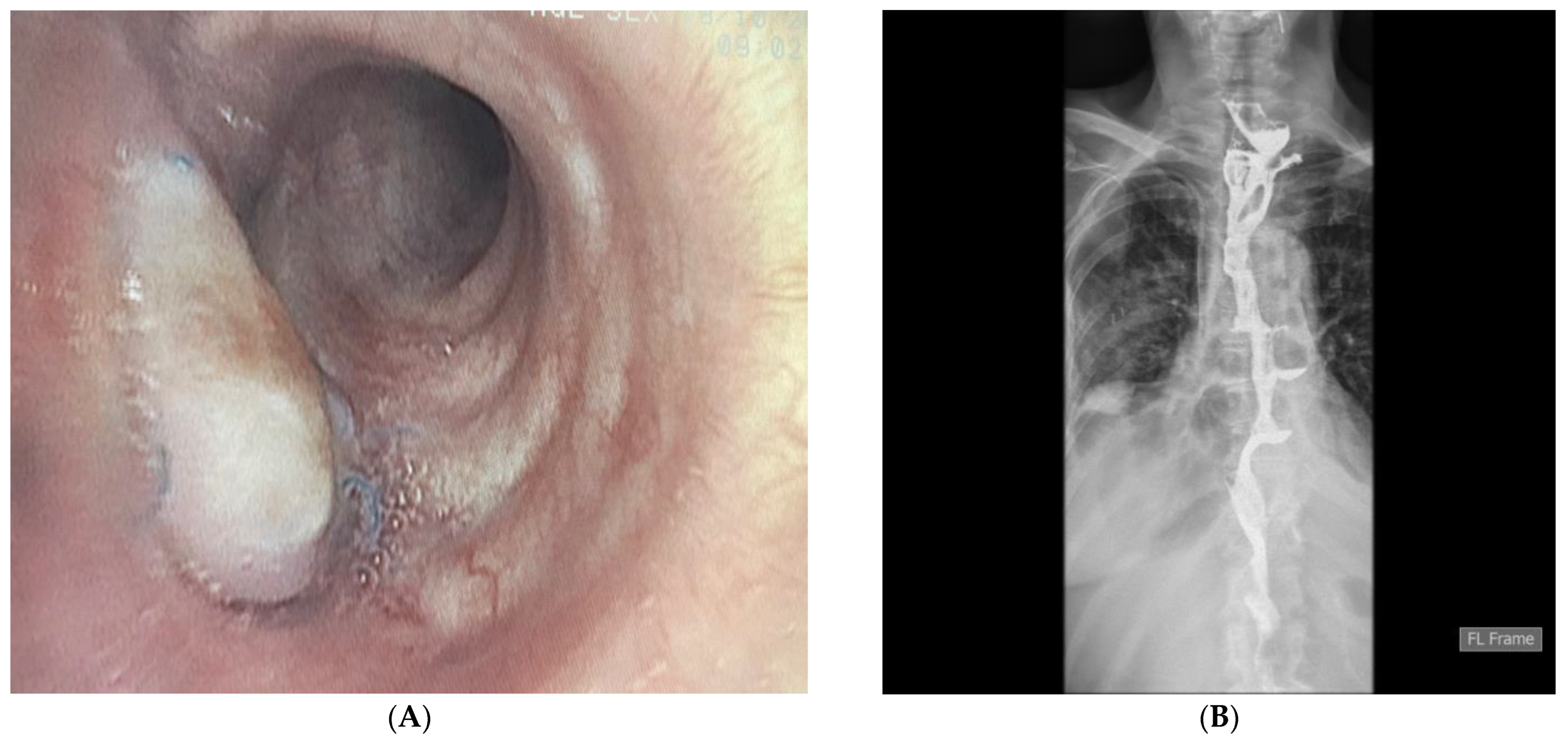 Diagnostics 14 02432 g004