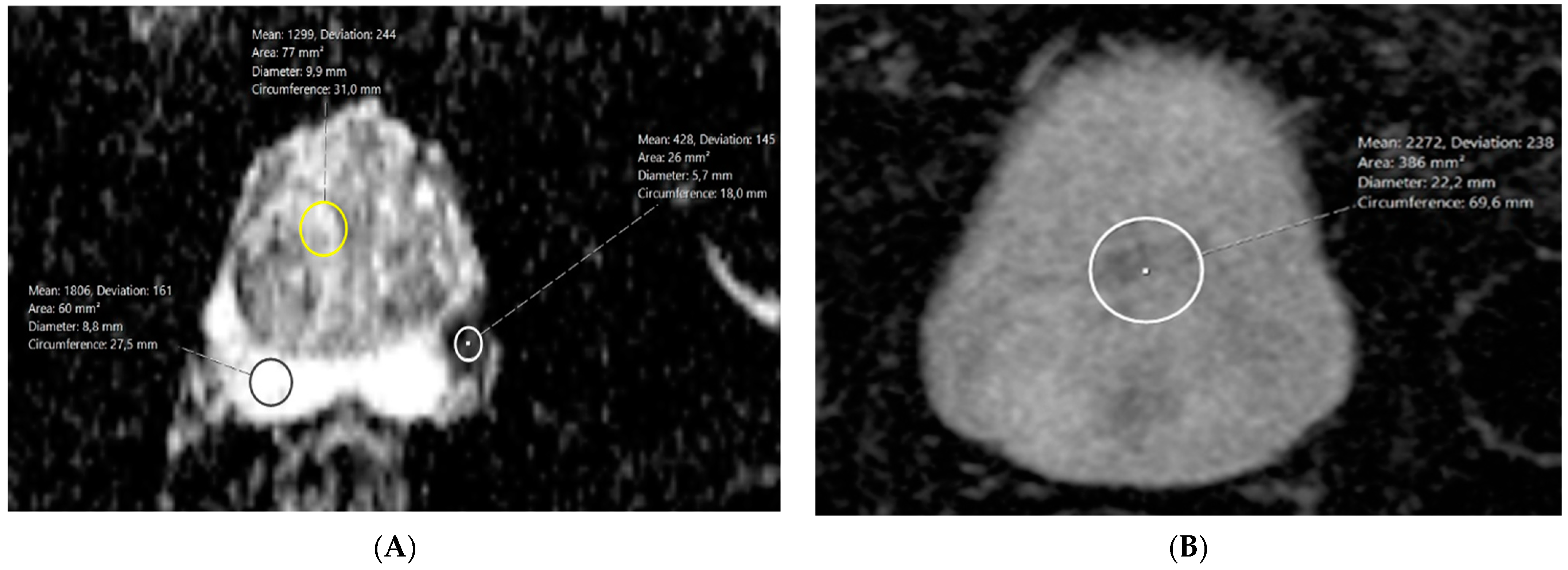 Diagnostics 14 02438 g002