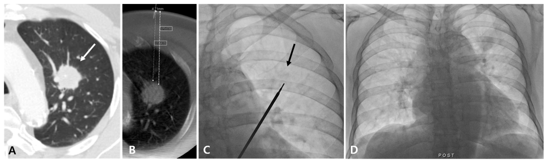 Diagnostics 14 02441 g001
