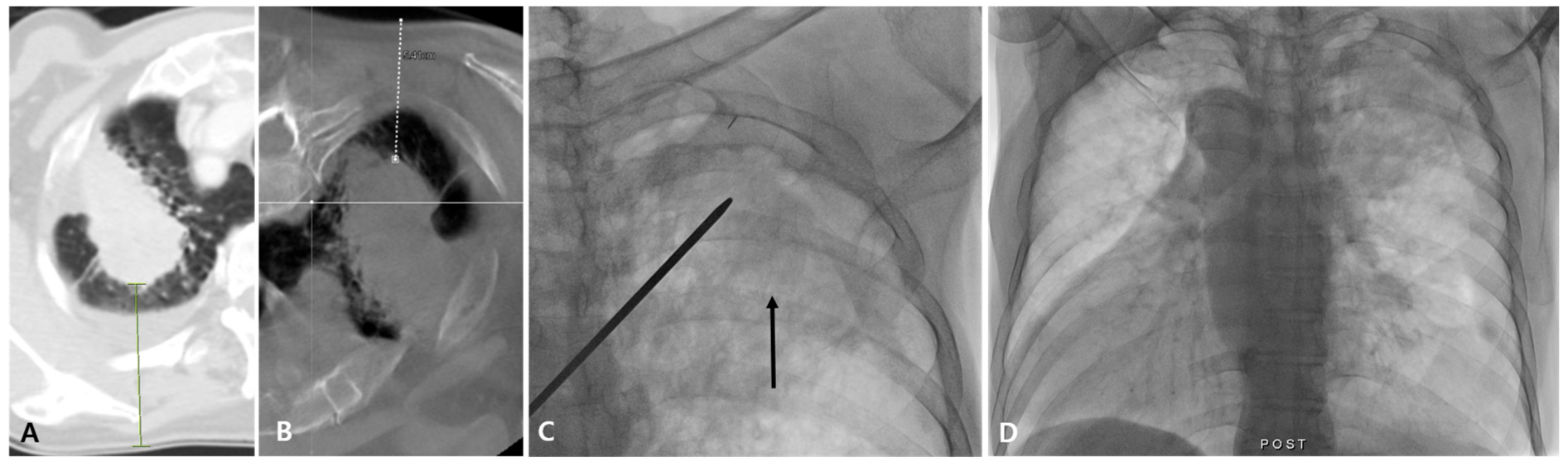Diagnostics 14 02441 g003