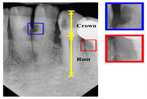 Diagnostics 14 02442 i003