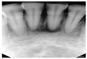 Diagnostics 14 02442 i004