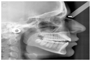 Diagnostics 14 02442 i005