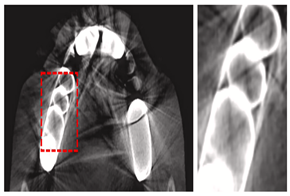 Diagnostics 14 02442 i006
