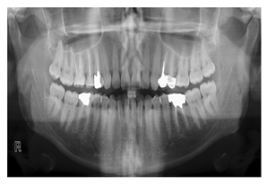 Diagnostics 14 02442 i007