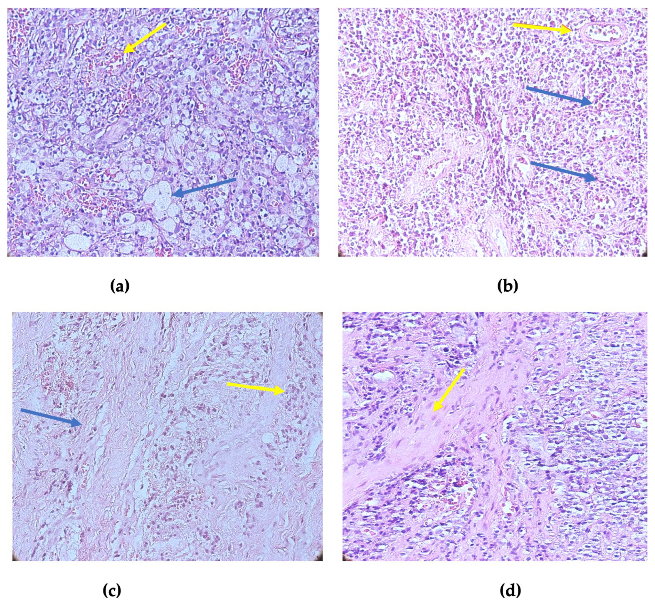 Diagnostics 14 02446 g002