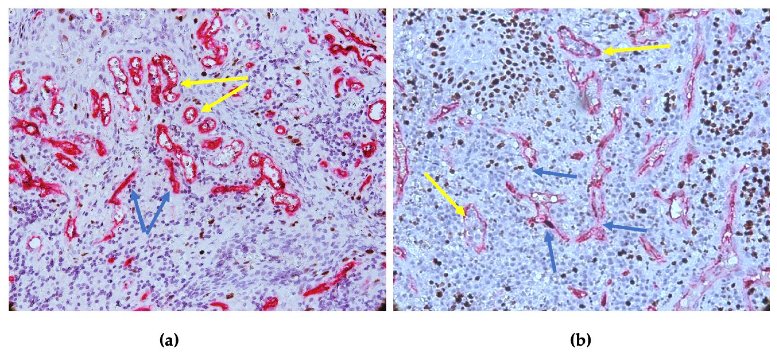 Diagnostics 14 02446 g005