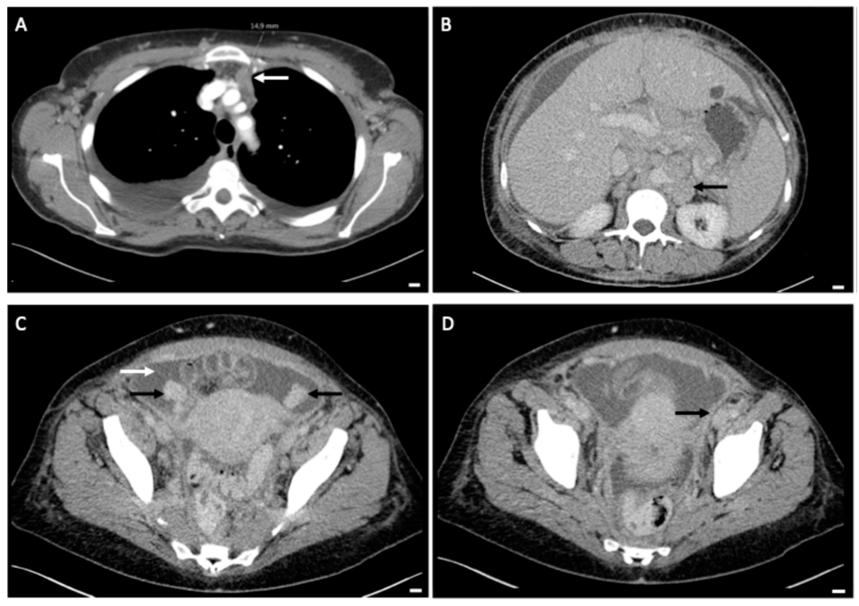 Diagnostics 14 02449 g002