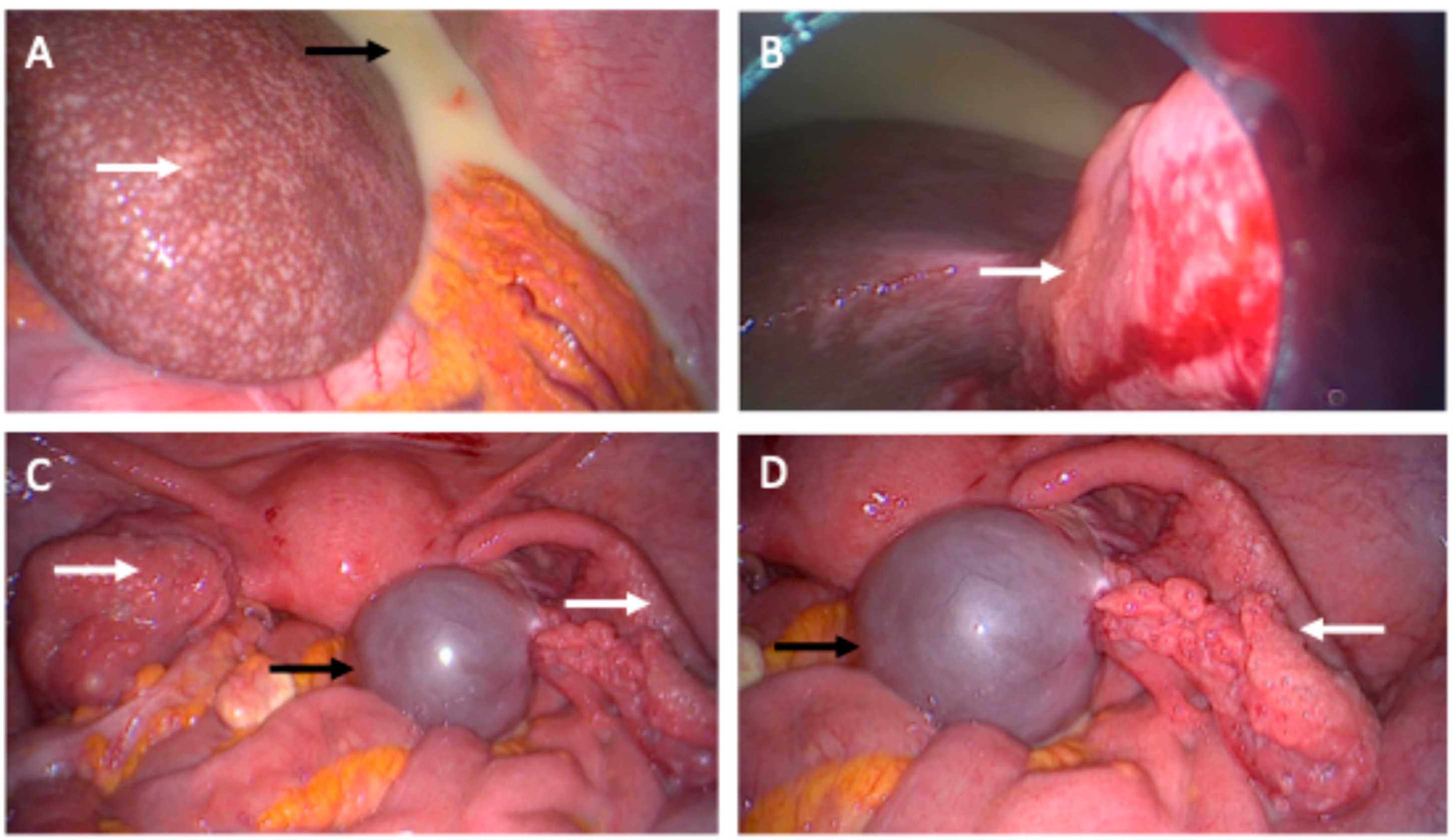 Diagnostics 14 02449 g003