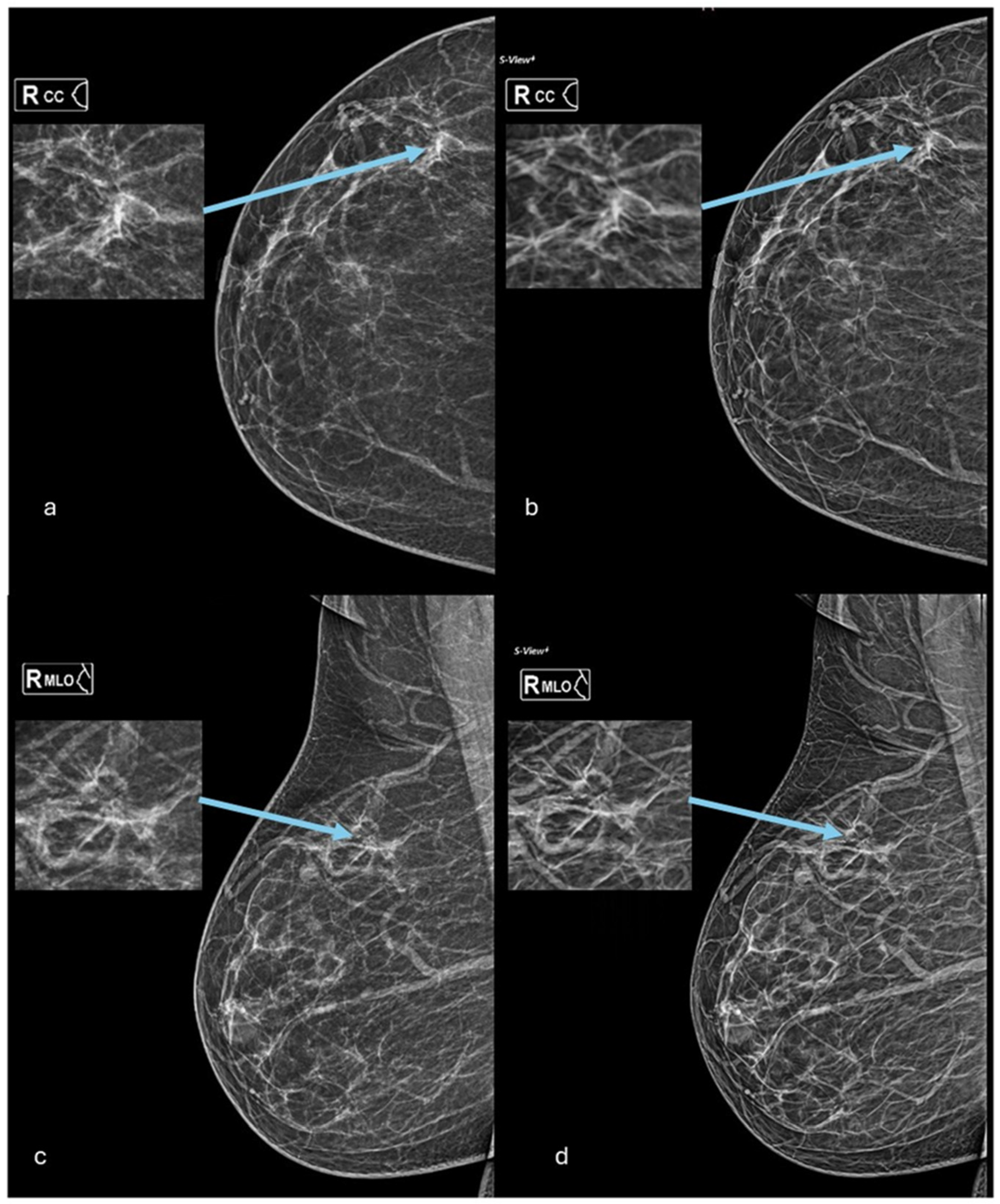 Diagnostics 14 02452 g002