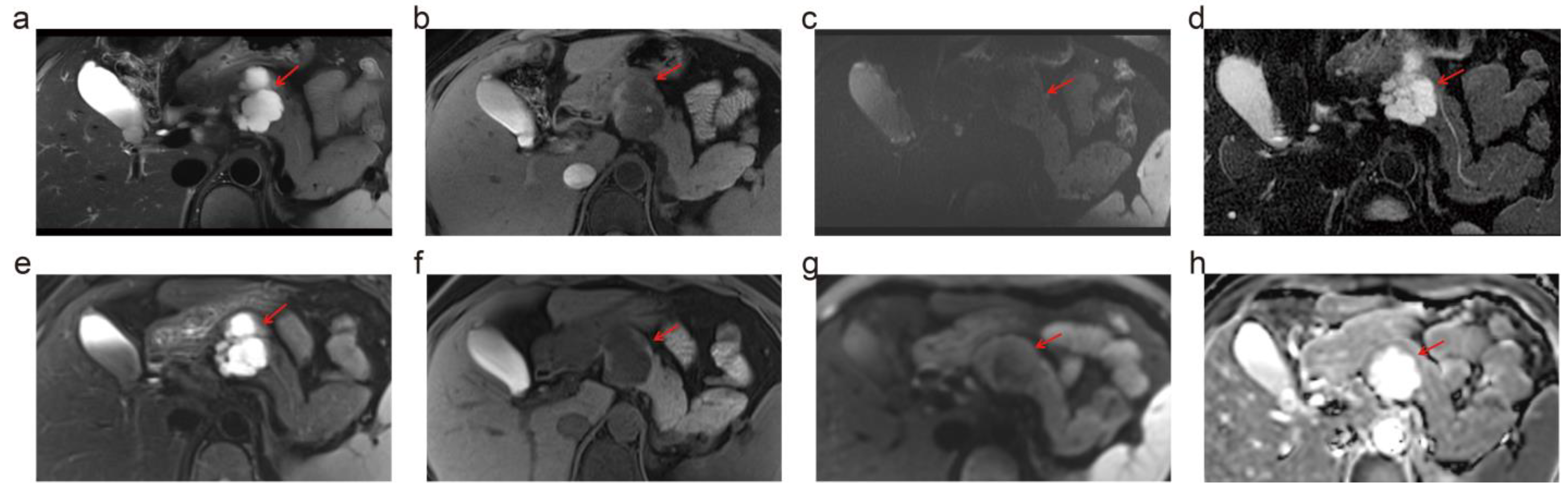 Diagnostics 14 02457 g003
