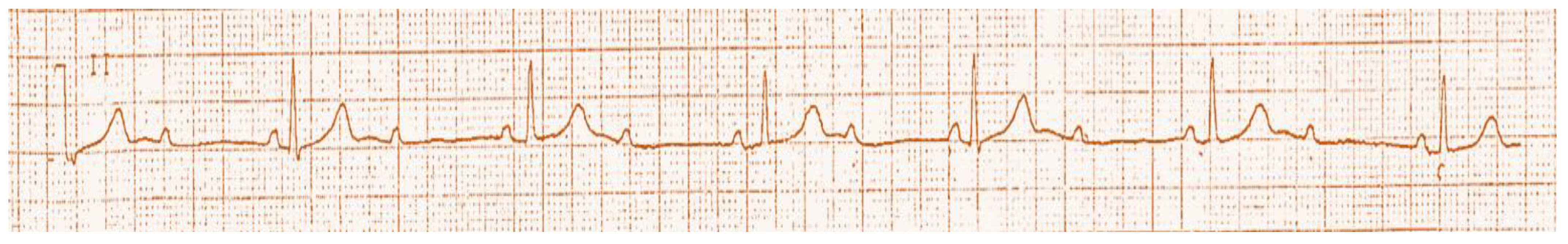 Diagnostics 14 02465 g001