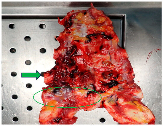 Diagnostics 14 02472 g002