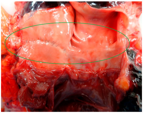 Diagnostics 14 02472 g004