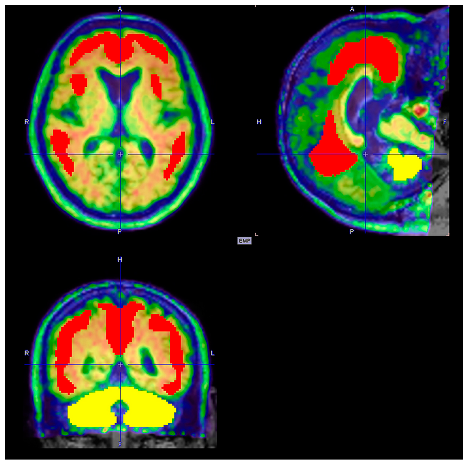 Diagnostics 14 02474 g006 Diagnostics 14 02474 g006