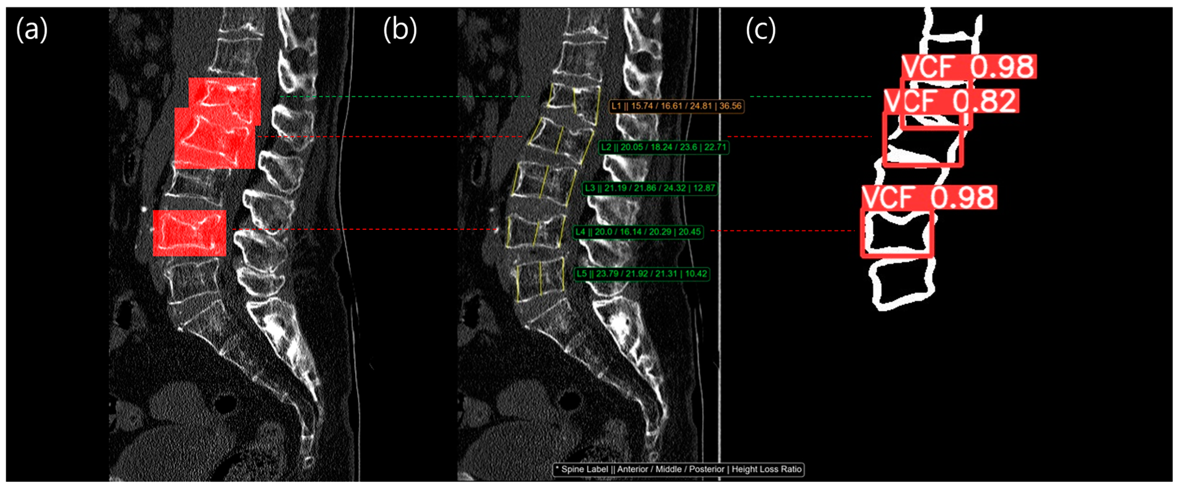 Diagnostics 14 02477 g006