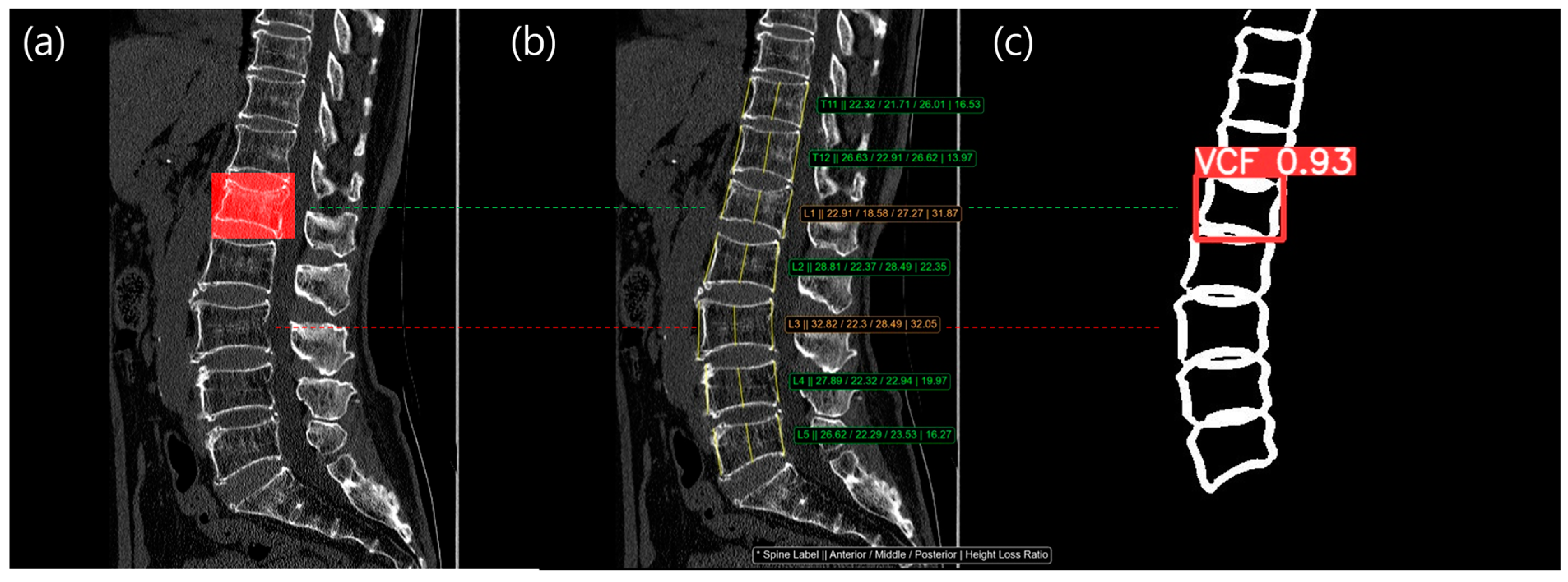 Diagnostics 14 02477 g007