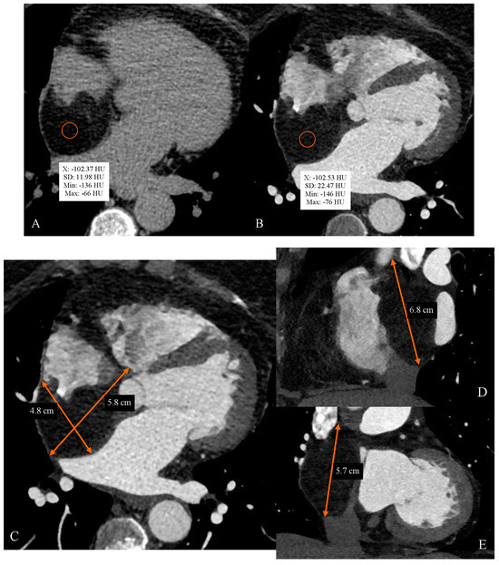 Diagnostics 14 02496 g001a