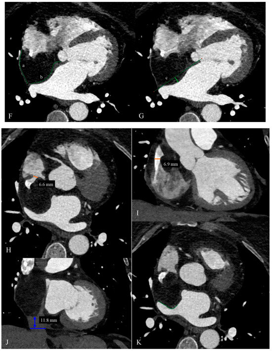 Diagnostics 14 02496 g001b