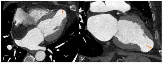Diagnostics 14 02496 g001c