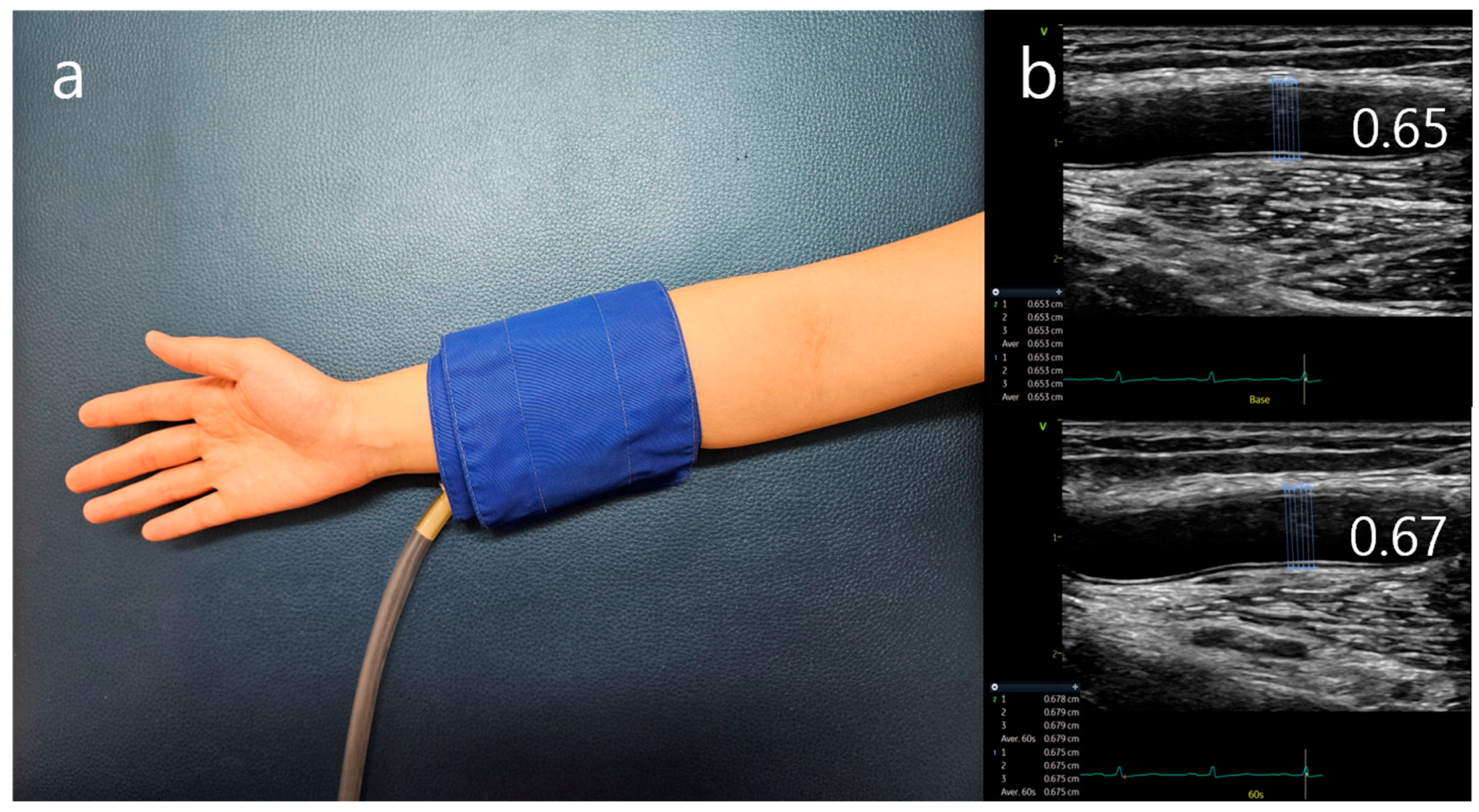 A Comprehensive Review of Clinical Studies Applying Flow-Mediated ...