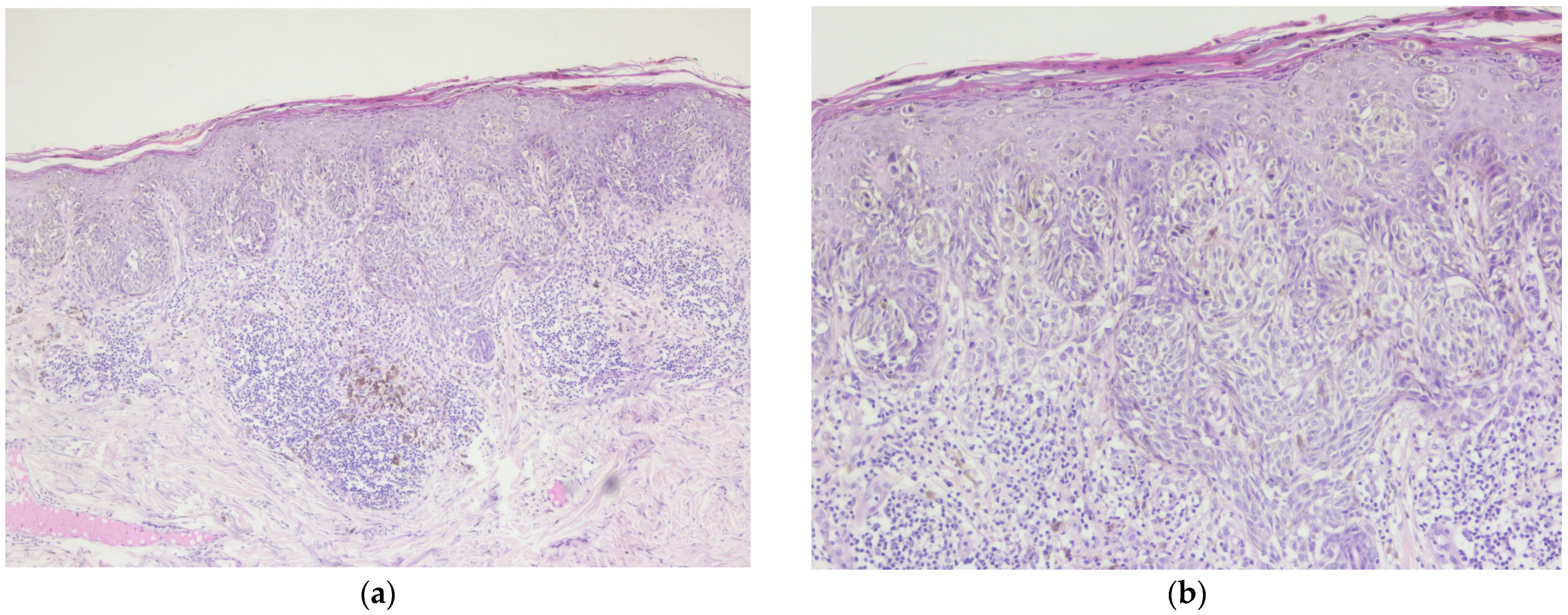 Diagnostics 14 02510 g001
