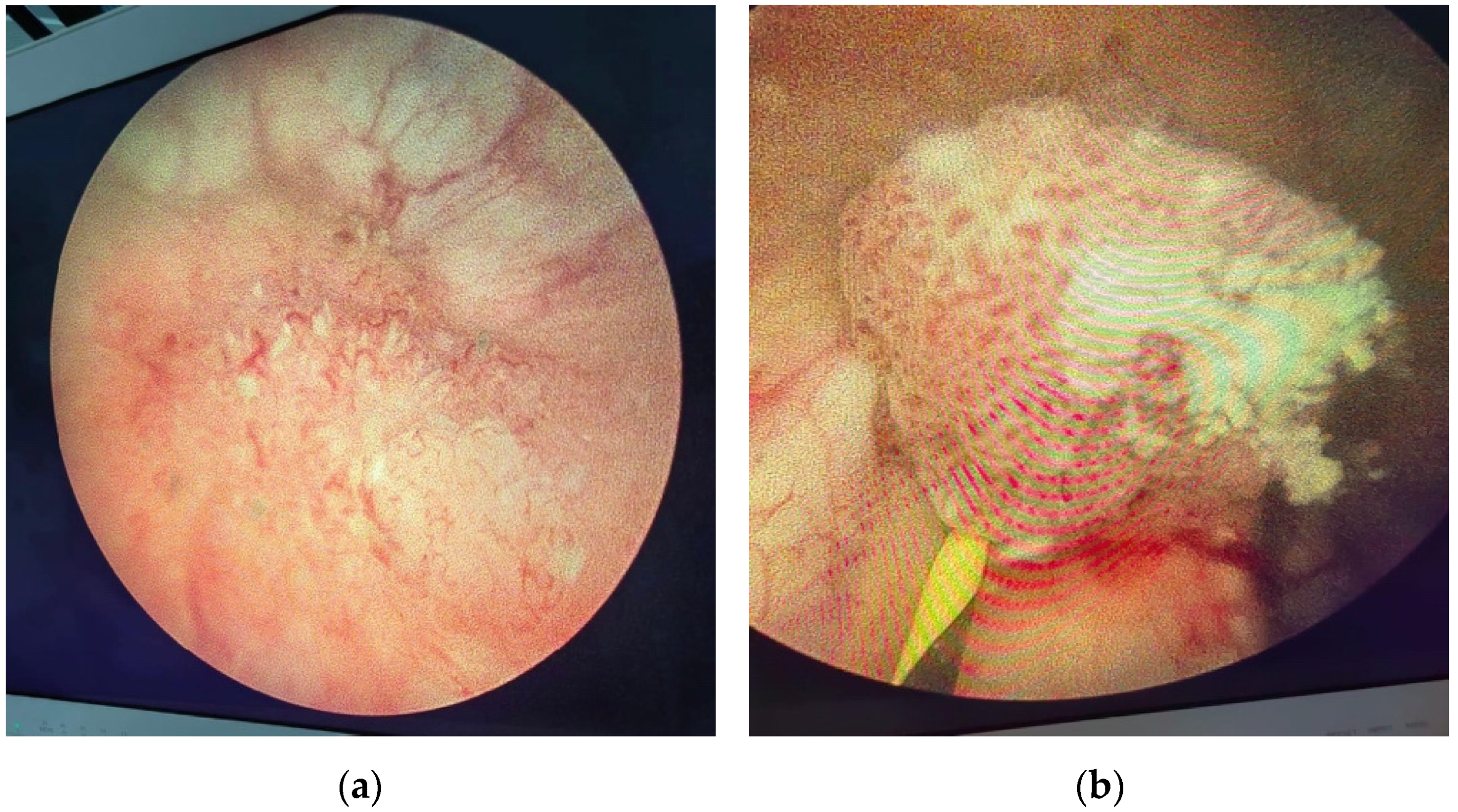 Diagnostics 14 02510 g007