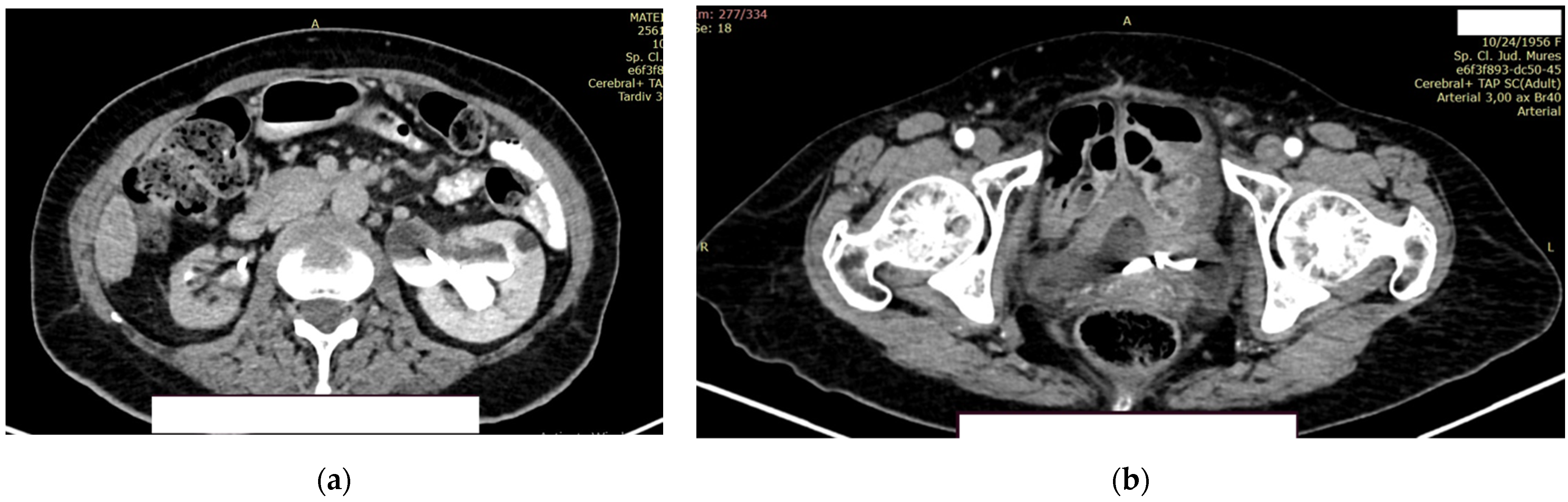 Diagnostics 14 02510 g009