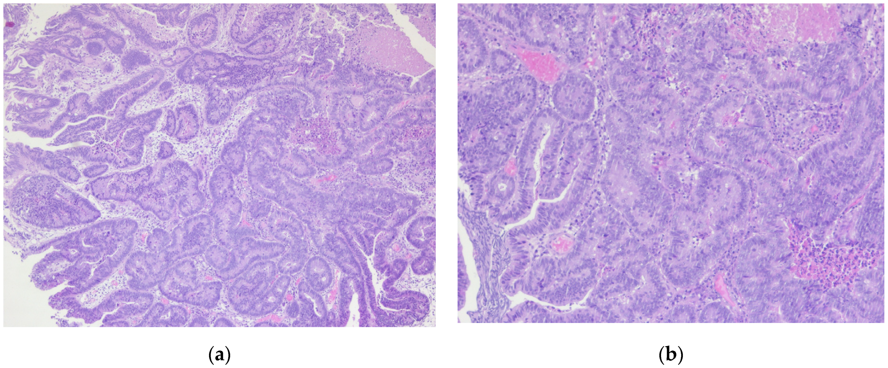 Diagnostics 14 02510 g010