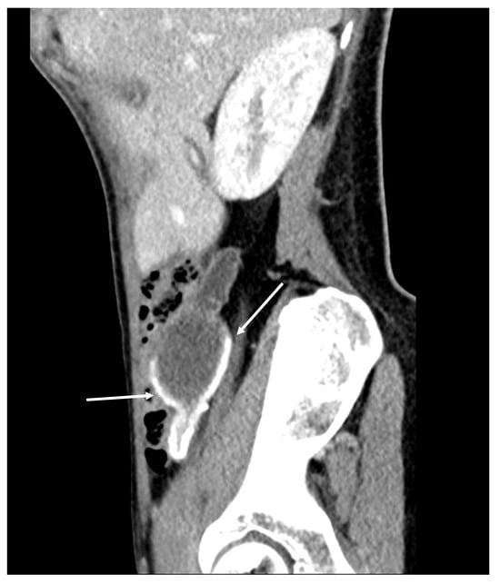 Diagnostics 14 02532 g002