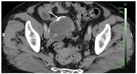 Diagnostics 14 02532 g003
