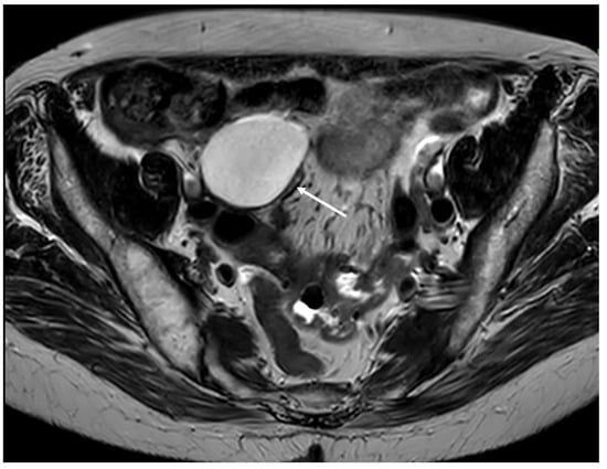 Diagnostics 14 02532 g004